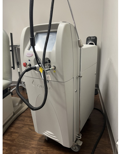candela vbeam perfecta 595 nm pulsed dye laser 2013