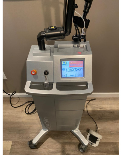 cynosure smartskin co2 laser skin resurfacing 2014 sale
