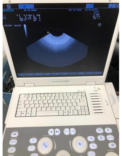 acuson p300 ultrasound system sale