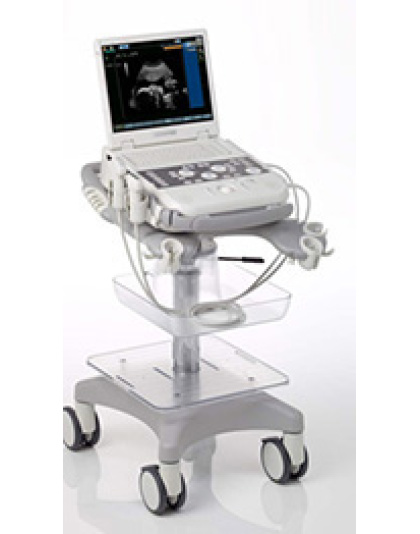 acuson p300 ultrasound system sale