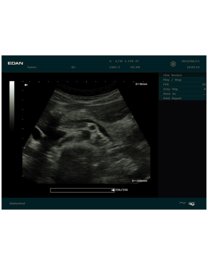 edan dus60 digital ultrasound sale