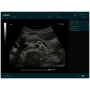 edan dus60 digital ultrasound sale