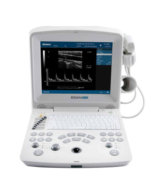 edan dus60 digital ultrasound sale