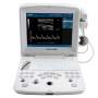 edan dus60 digital ultrasound sale