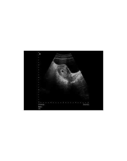 siui ultrasound scanner cts5500 plus battery sale