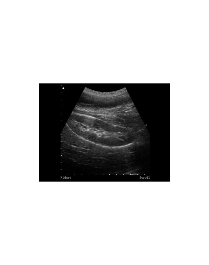 siui ultrasound scanner cts5500 plus battery sale