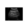 siui ultrasound scanner cts5500 plus battery sale
