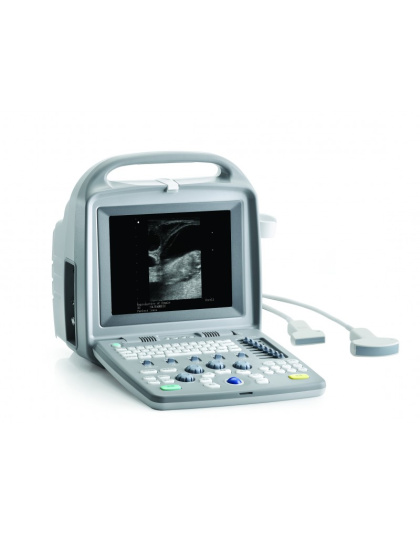 siui ultrasound scanner cts5500 plus battery sale