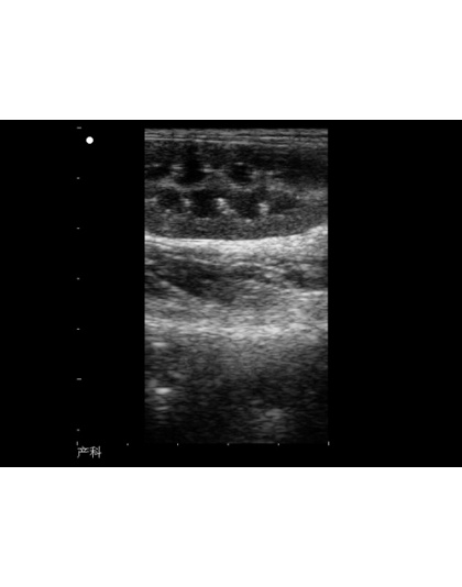 siui ultrasound scanner cts900 sale