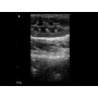 siui ultrasound scanner cts900 sale