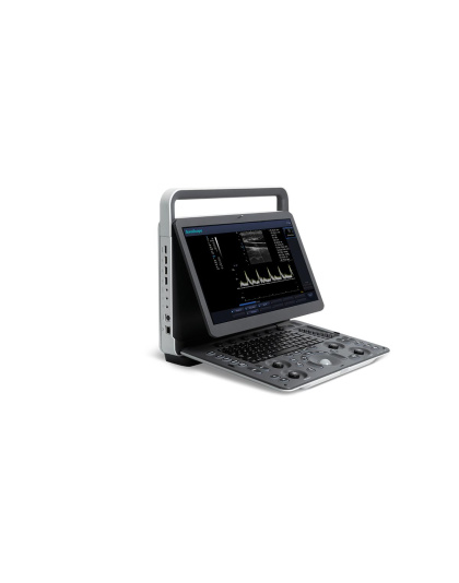 sonoscape e1 portable ultrasound sale