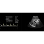 sonoscape e1 portable ultrasound sale