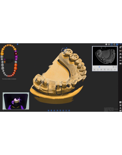 degree freedom dof freedom hd dental scanner sale