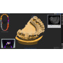 degree freedom dof freedom hd dental scanner sale
