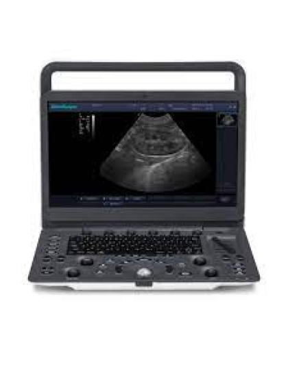 sonoscape e1 portable ultrasound sale