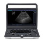 sonoscape e1 portable ultrasound sale