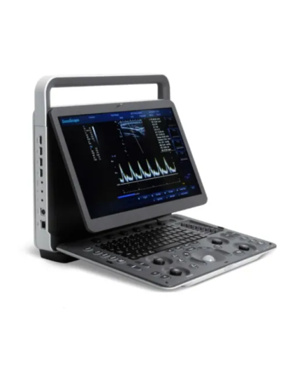 sonoscape e1 portable ultrasound sale