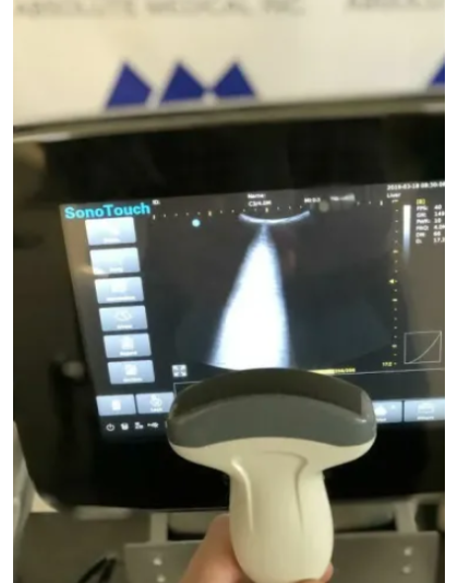 chison c3 curved array ultrasound probe sale