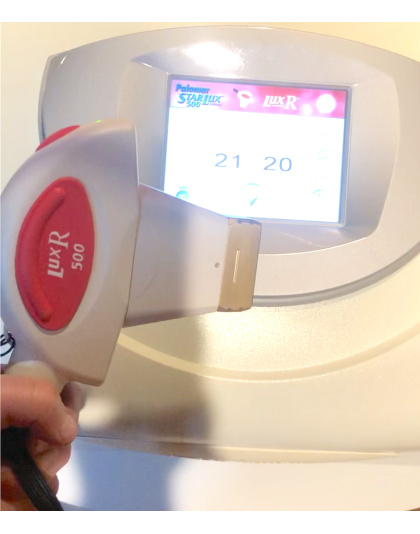 cynosure palomar starlux 500 5 handpieces 2013 sale