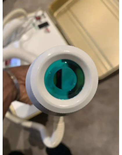 aerolase lightpod neo 2013 sale