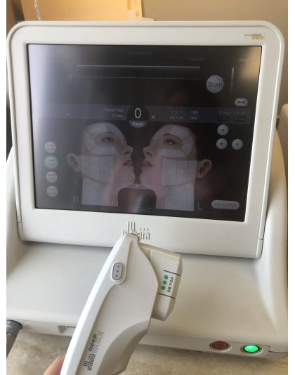 ulthera ultherapy ultrasound skin tightening system laser 2013 sale