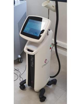 candela frax pro hair removal laser